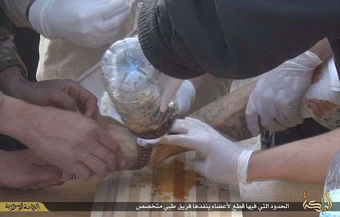 Бойовики ИГИЛа знову відрубали руку вору (8 фото)