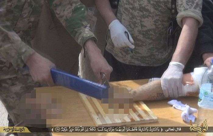Бойовики ИГИЛа знову відрубали руку вору (8 фото)