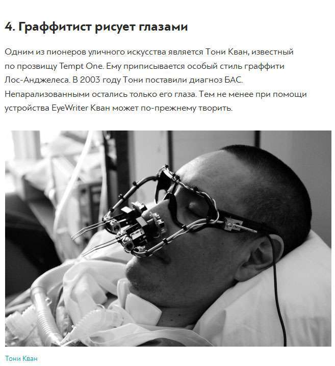 Історії людей з «синдромом замкненого людини» (8 фото)