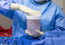 Справедливість у трансплантації органів покращується зі збільшенням нагляду