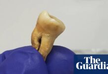 Starověký masový hrob potvrzuje závažnost první globální pandemie