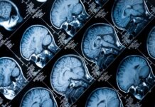 Персоналізована медицина: прогрес сповільнився, але залишається життєво важливим