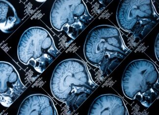 Персоналізована медицина: прогрес сповільнився, але залишається життєво важливим