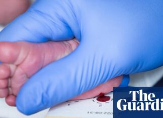 Шотландія Лідує у Великій Британії з Неонатального Скринінгу на Спинальну М’язову Атрофію