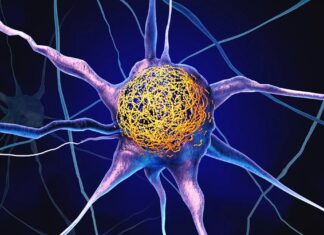 Рівень вітаміну D у середньому віці може захистити мозок від змін, пов’язаних із хворобою Альцгеймера