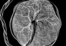 Карта незвіданого: вчені виявили загадковий тип клітин, необхідний вагітності